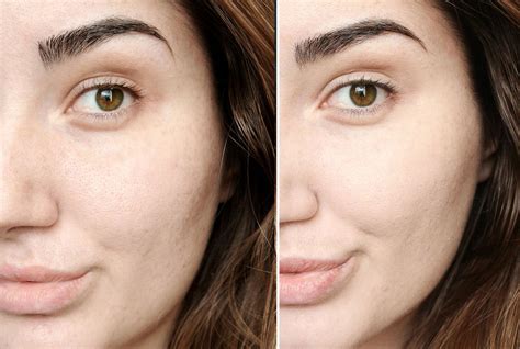 most full coverage chanel foundation|Chanel foundation before and after.